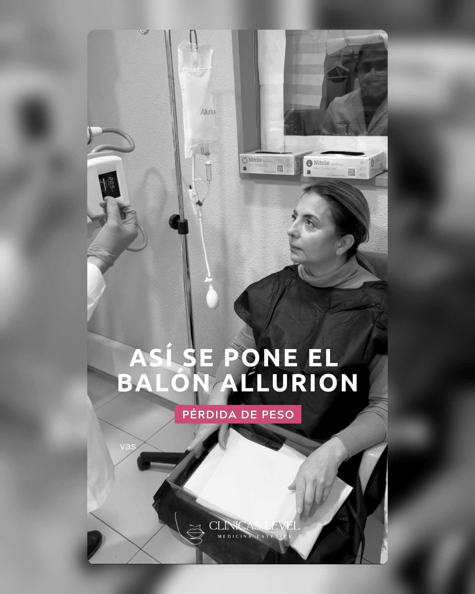 Proceso de balón Allurion y nutrición clínica