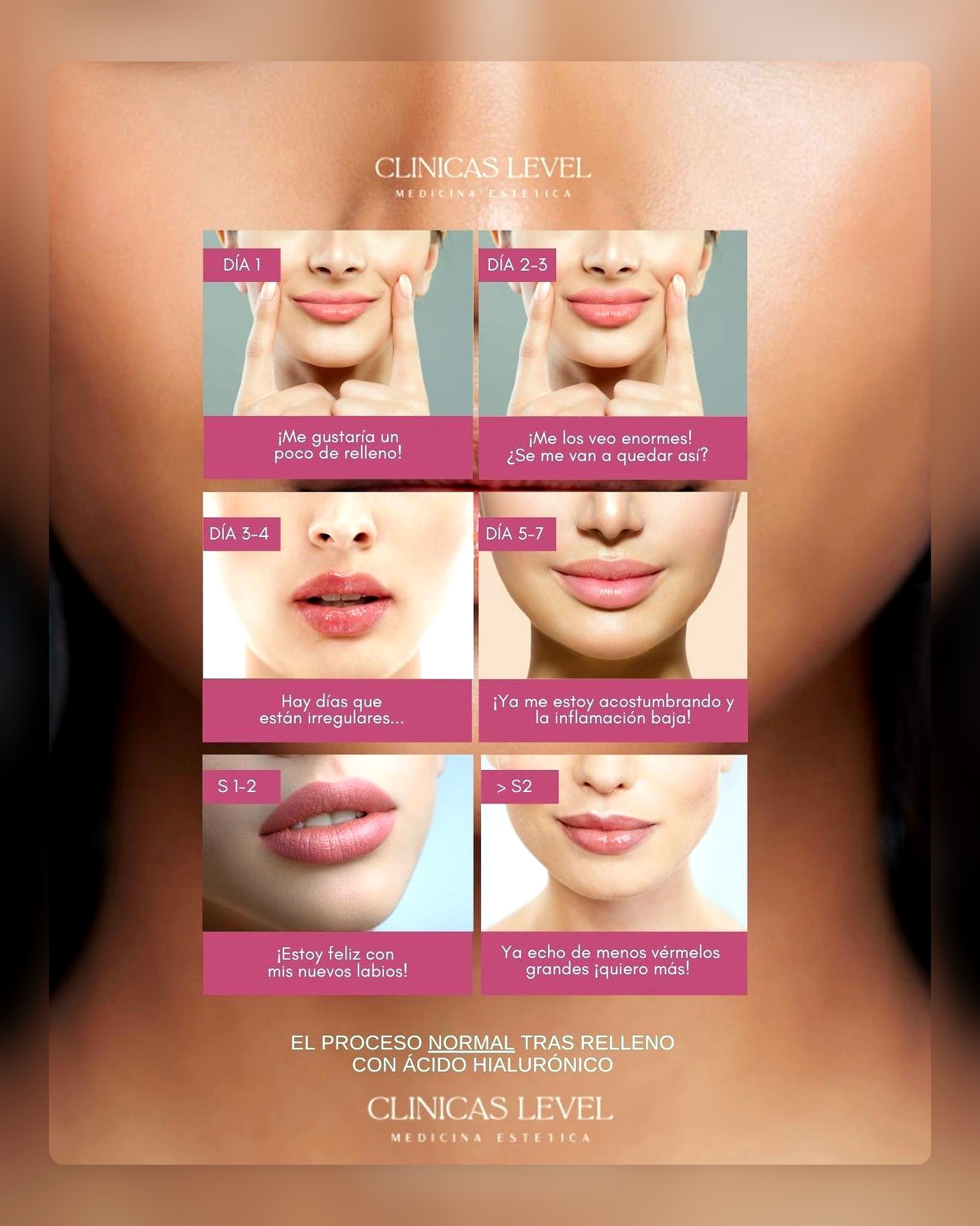 Aumento de labios y medicina estética facial