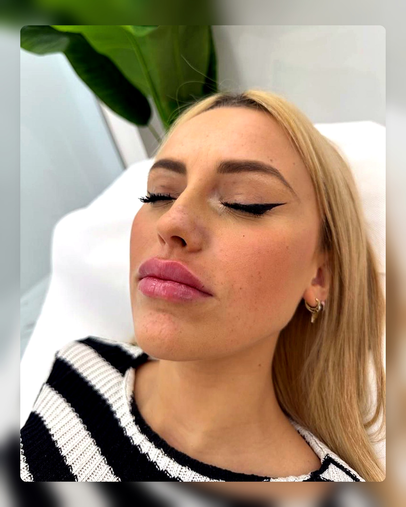 Medicina estética facial en Clínicas Level