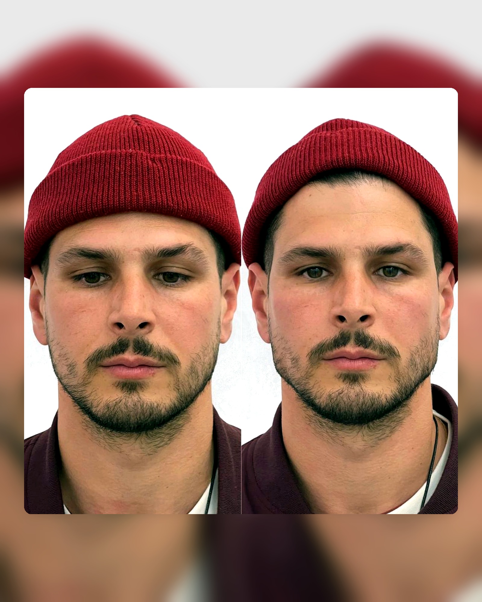 Imagen corporativa y resultado visual de la clínica